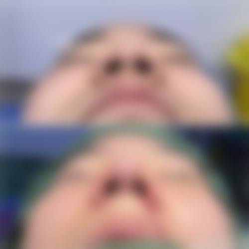 韩国世民整形外科医院口碑好不好?附真实患者口碑评价