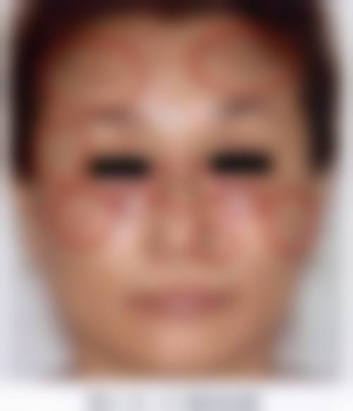 七、成都中优立美医疗美容诊所怎么样，评价