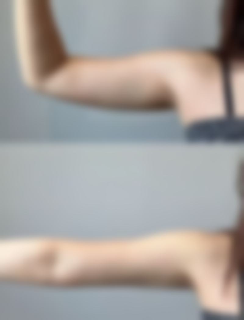 黑眼圈和眼袋怎去除——中医按摩的特殊技巧