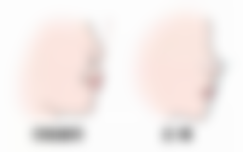 王淑兰医生简介做手术价格