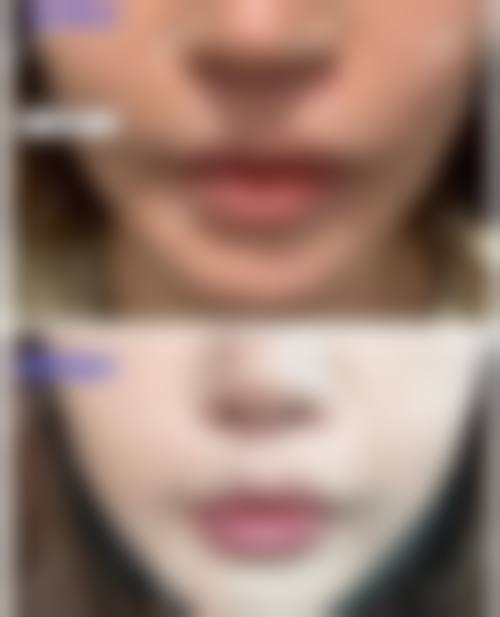 韩国奥来整形外科医院口碑好不好？附真实患者口碑评价