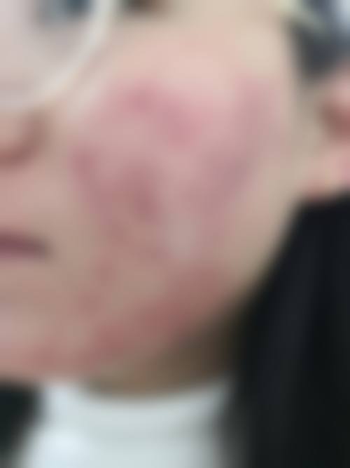 临沂恩卉艾臻医疗美容诊所怎么样，价格表