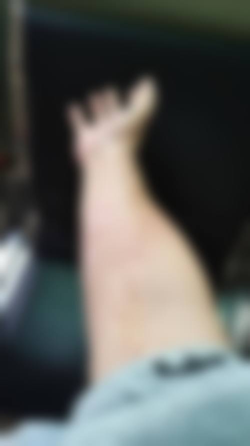 临沂恩卉艾臻医疗美容诊所怎么样，评价