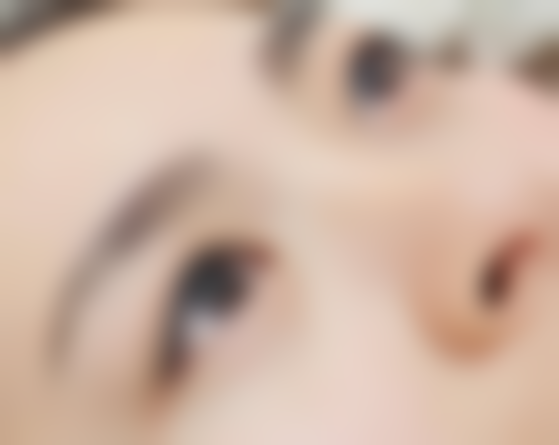 隆鼻感染后多久可以做修复：控制感染再修复