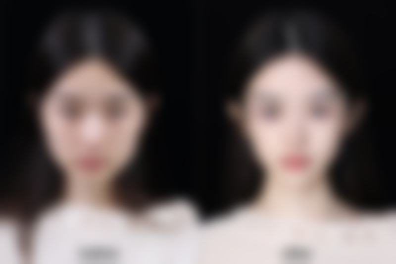 黄健勇医生项目优势