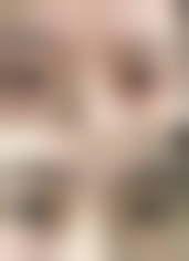 上海仁济医院整形美容科价格表