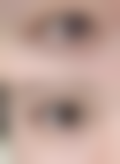 王淑兰医生简介项目优势