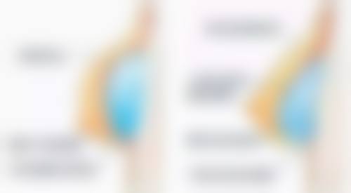 二、医院医美消除黑眼圈大眼袋成效如何？