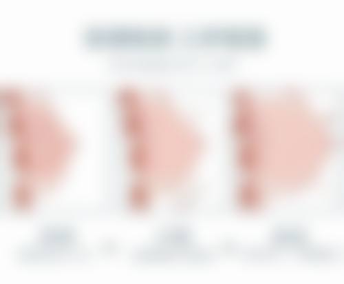 三、医院推荐按摩消除黑眼圈大眼袋的技巧