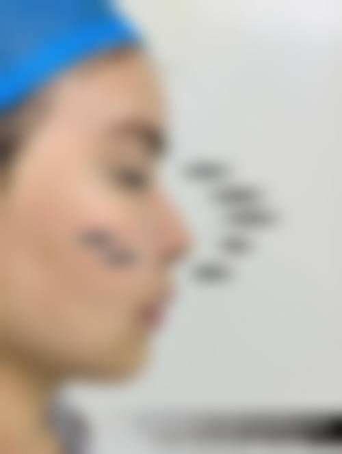 广水市第一人民医院整形美容科怎么样，口碑评价如何？