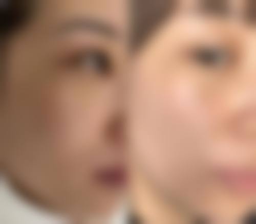 南阳美尔雅整形医院口碑评价