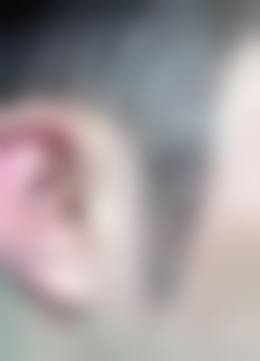 湖南发友汇植发门诊部价格表