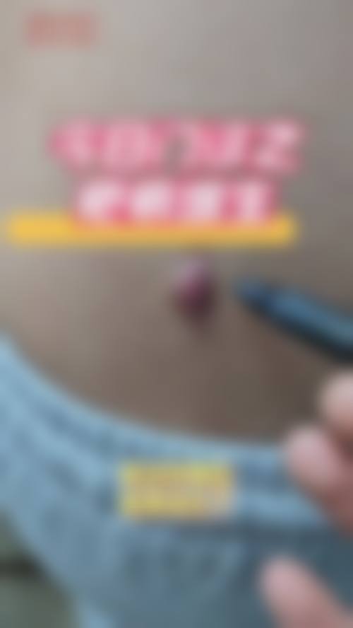 南阳美尔雅整形医院真实患者口碑评价