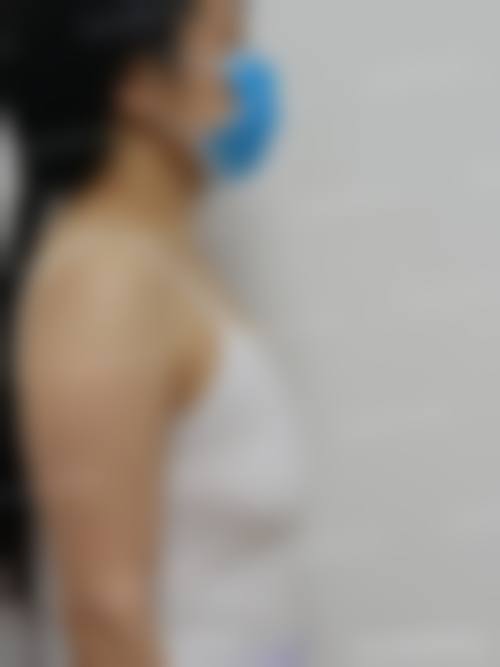 泰国SiriWellness Center（思丽）整形医院价格表