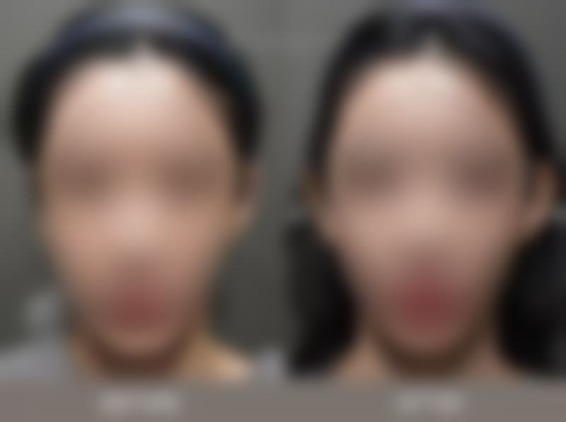 李富春医生项目优势