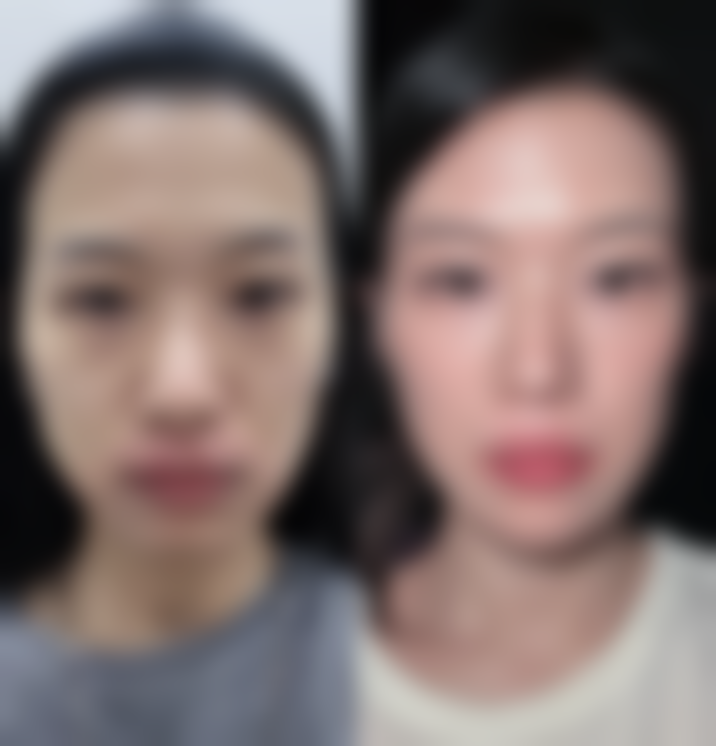 上海德琳医疗美容医院（男性私密中 心）选择乐威主事的利与弊分析