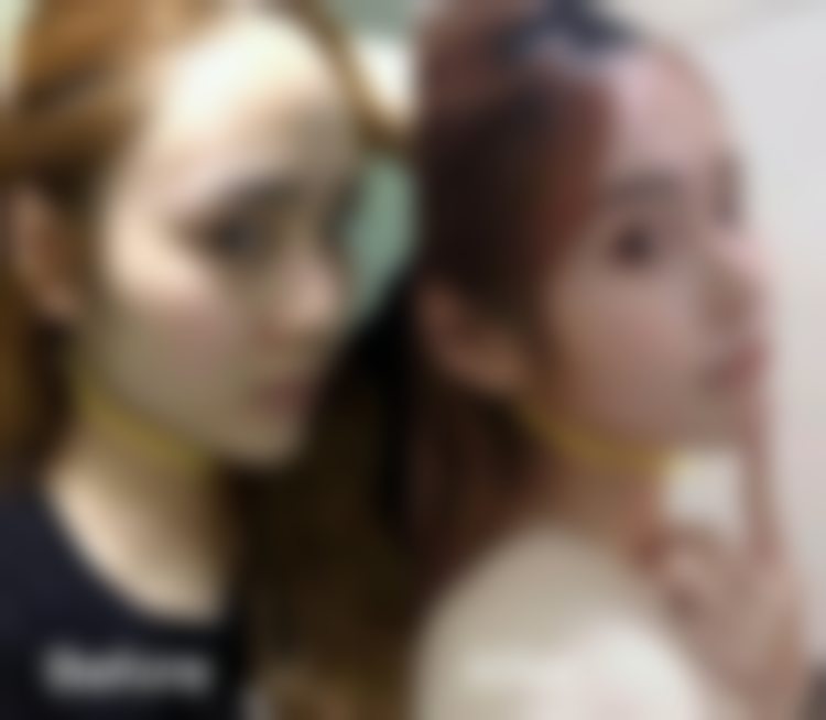 如何预约医院的2500元嗨体祛颈纹新客特别优惠