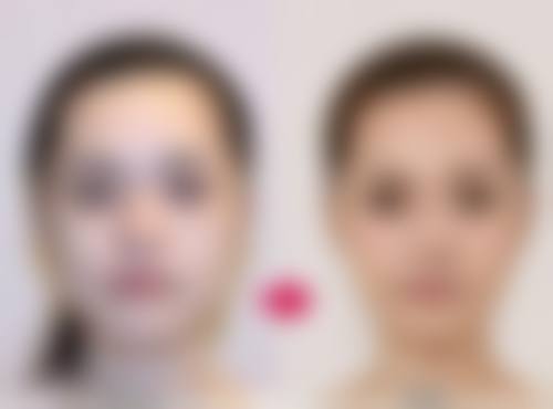 王殿峰医生口碑如何