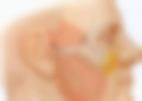 什么办法可以淡化缝针疤痕之自体脂肪填充——凹陷疤痕的“填充大师”