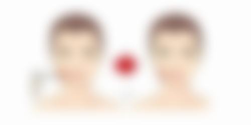 小腿肚抽脂医院与费用考量