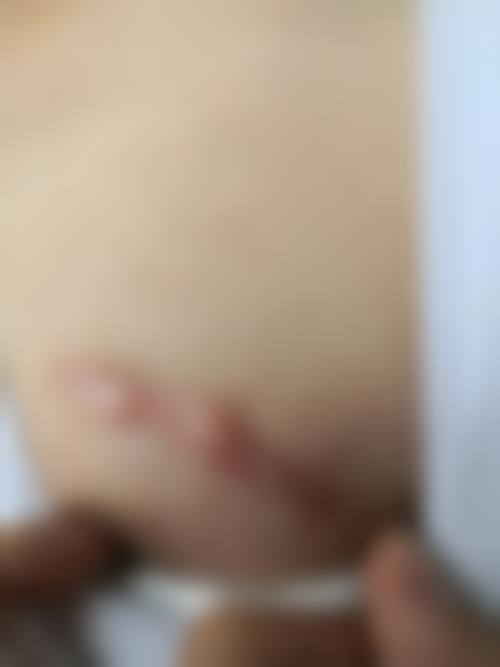 陈庆划医生简介项目优势