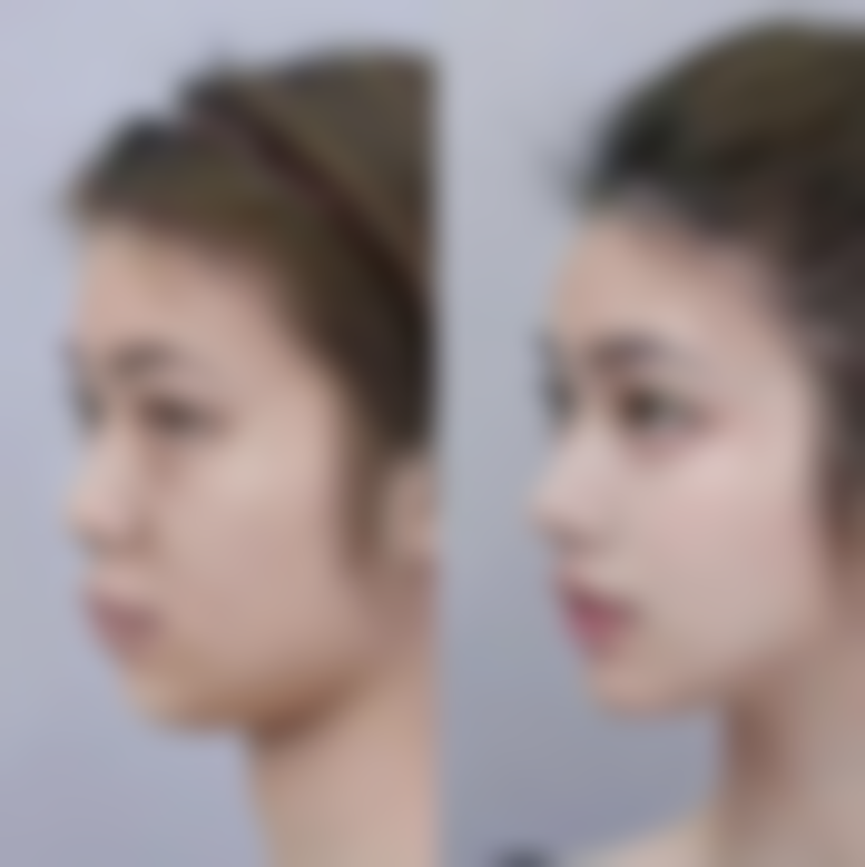 沈阳鱼涵朵医疗美容门诊部顾客实例