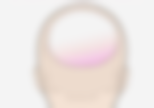 孩子脸上被指甲划伤的疤痕日常护理“五要五不要”