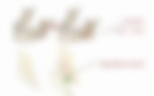 重度黑眼圈眼袋怎么去除：成功实例分享