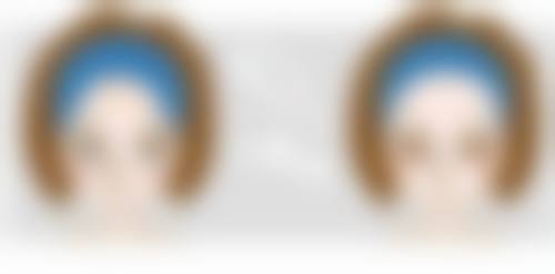 孩子脸上被指甲划伤的疤痕3招淡化神操作