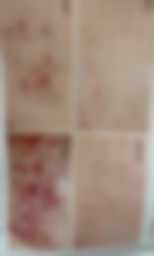 解放军总医院第一附属医院（304）医院生殖整形科项目特色