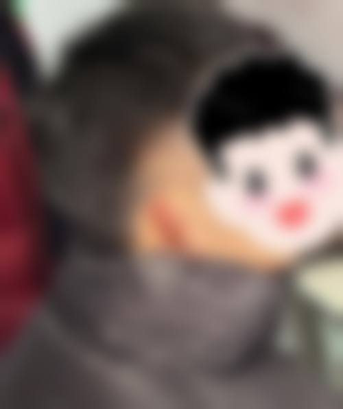 吴佳纯医生简介做手术价格