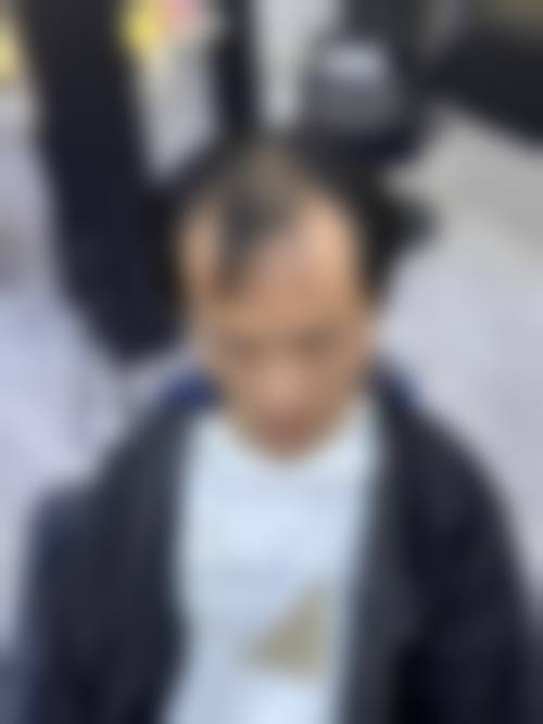 郝冬医生做手术价格