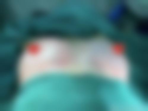 郝冬医生项目优势