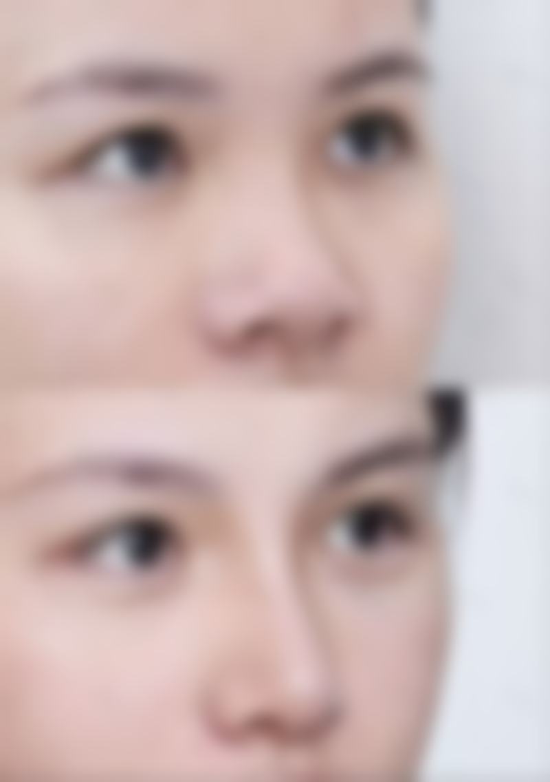 郝冬医生顾客实例图片