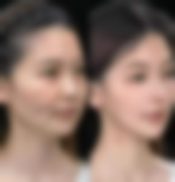 洛阳臻美丽医疗美容门诊部价格表