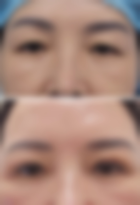 刘慧洁医生做手术价格