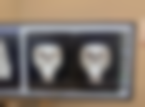 孩子脸上被指甲划伤的疤痕心理建设