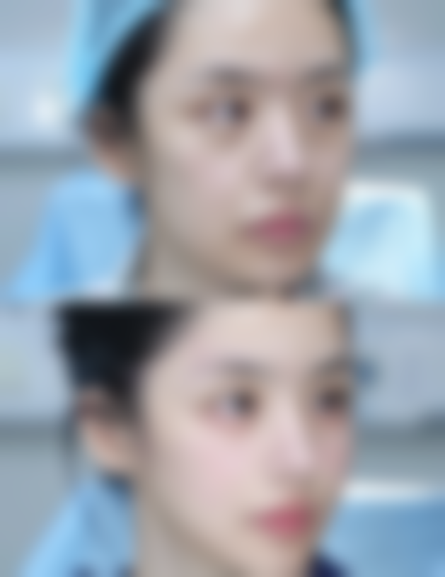 长沙美之峰医疗美容机构抖音团购活动有哪些，价格表