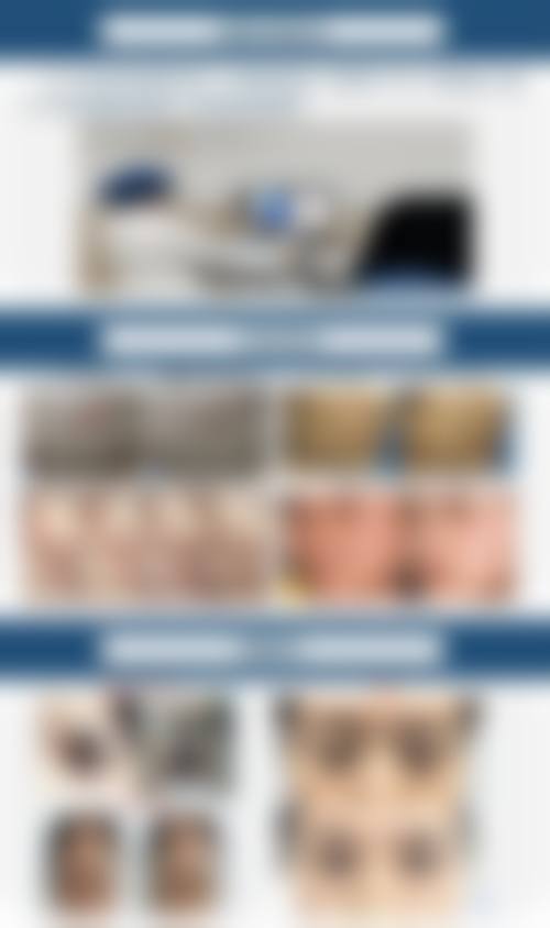 上海韩春民整形医院价格表