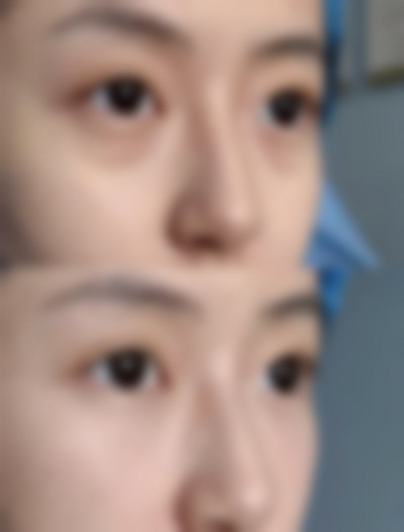 谢学峰医生简介做手术价格