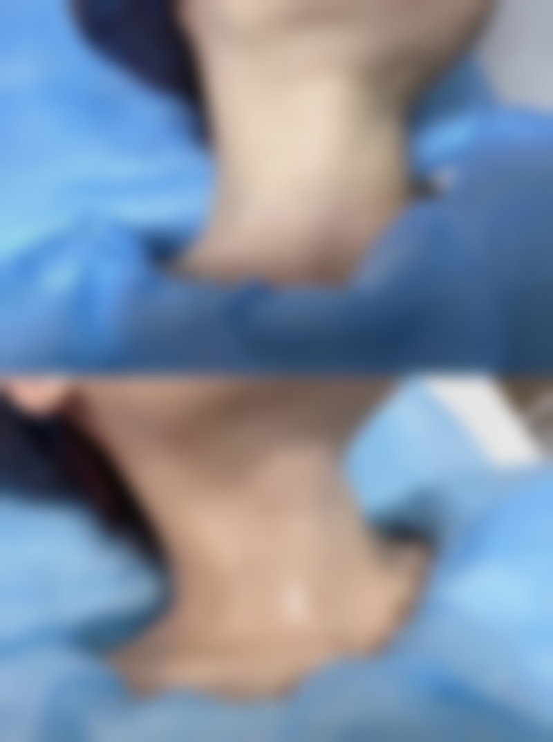 上海韩春民整形医院项目特色