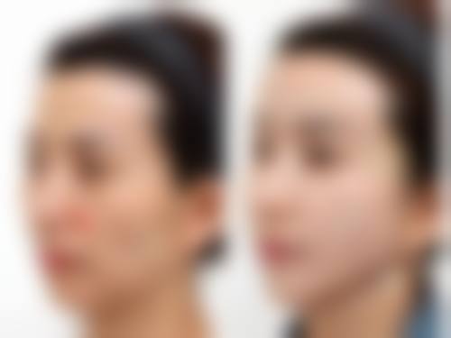 八、湘潭科凡美曾云医疗美容诊所价格表