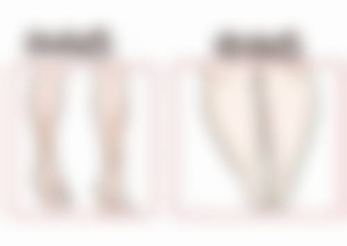 埋线双眼皮持久性之真相揭秘