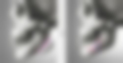 涂抹丰太阳穴靠谱吗？——副作用风险全方面评估