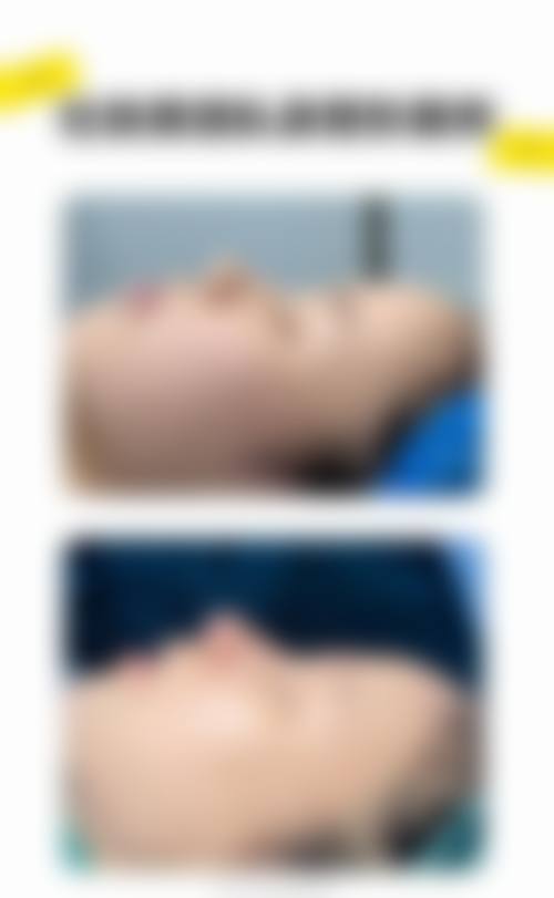 山东武警总队医院整形美容中 心项目特色