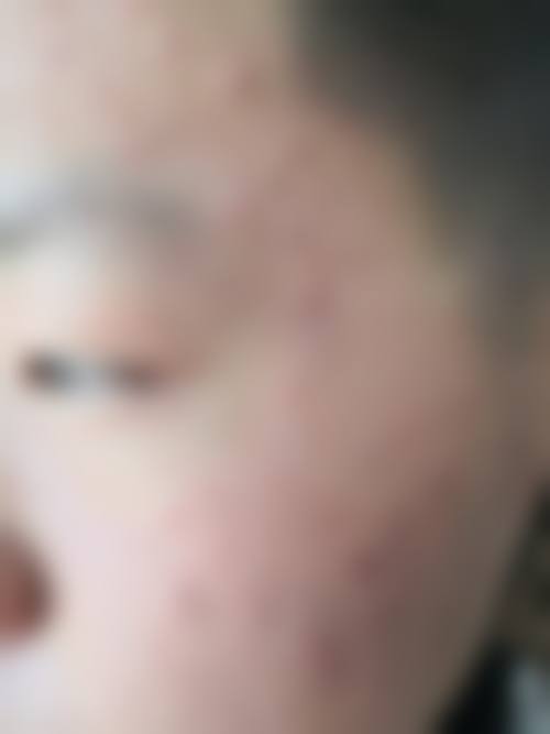 肖旭远医生项目优势