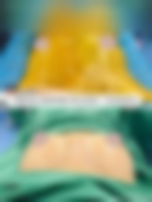 肖旭远医生做手术价格