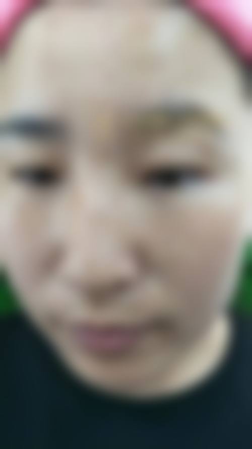 佛山梦露整形美容门诊部价格表