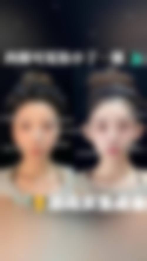 珠海真妍医疗美容诊所怎么样，价格表