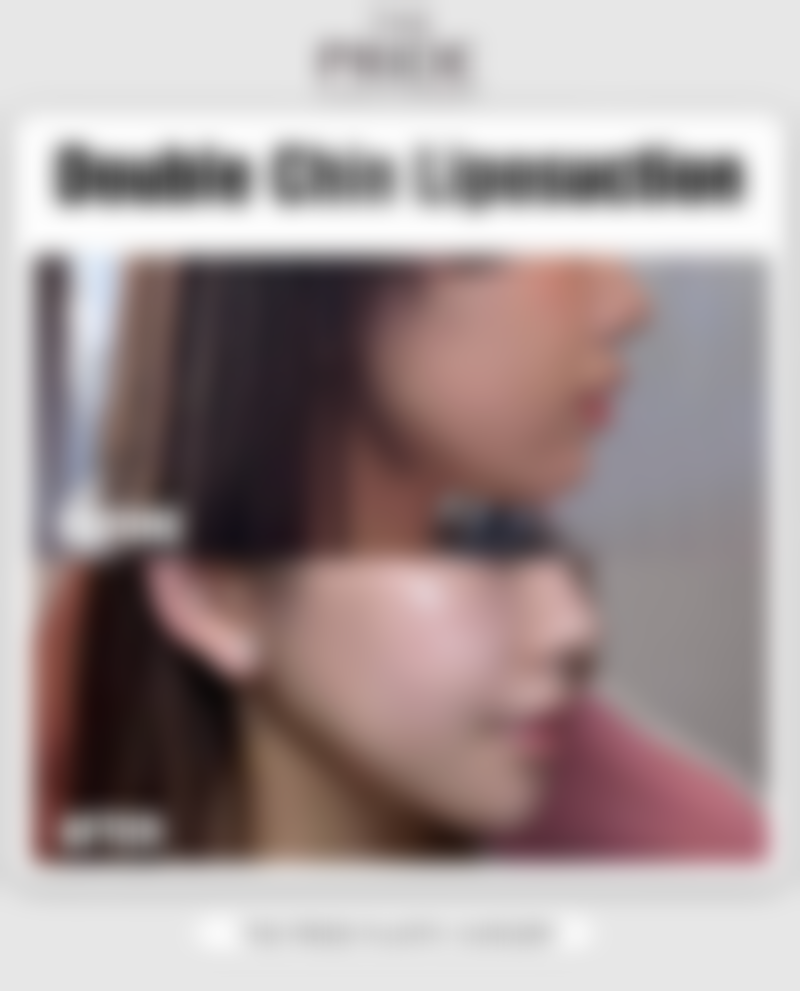 四、广州开水烫伤疤痕增生治疗的专精医院推荐